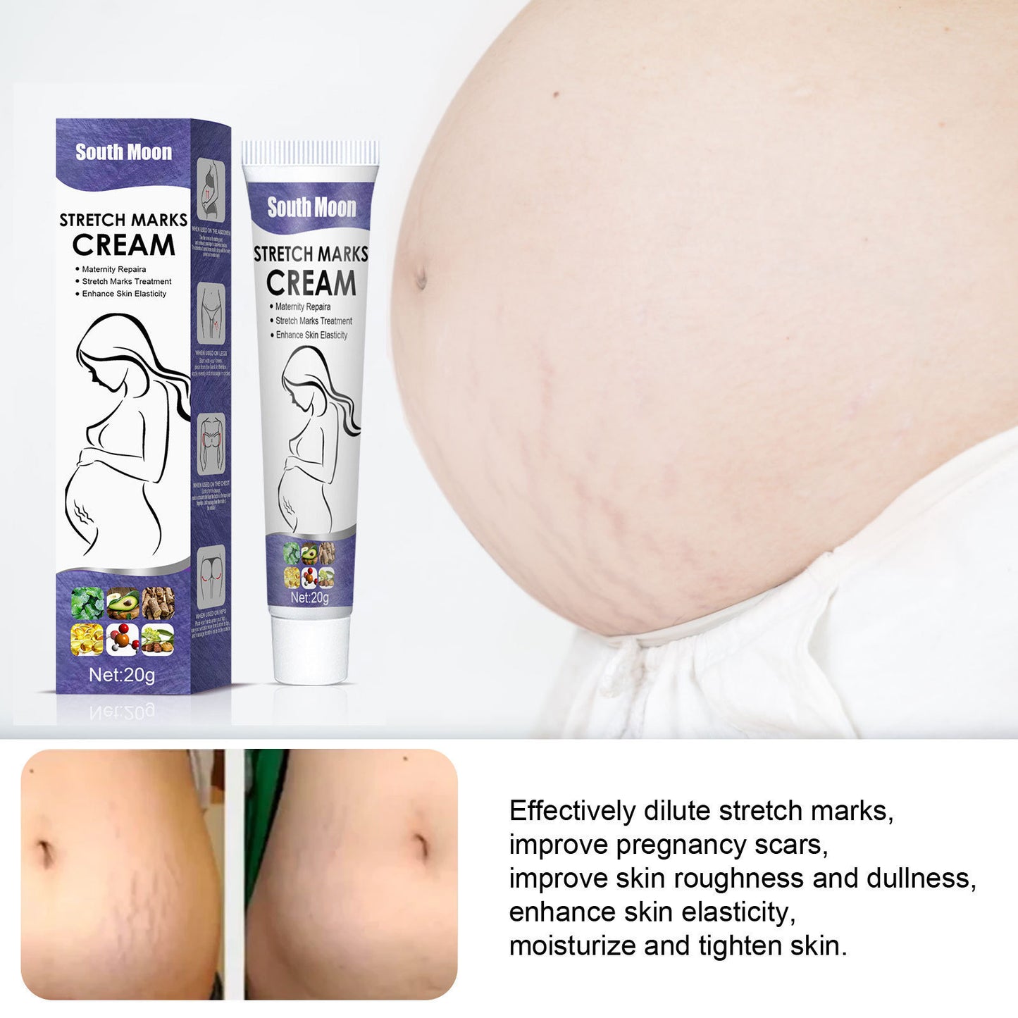 Skin Repair Cream for Stretch Marks