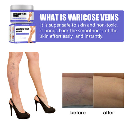 Vein Repair Cream