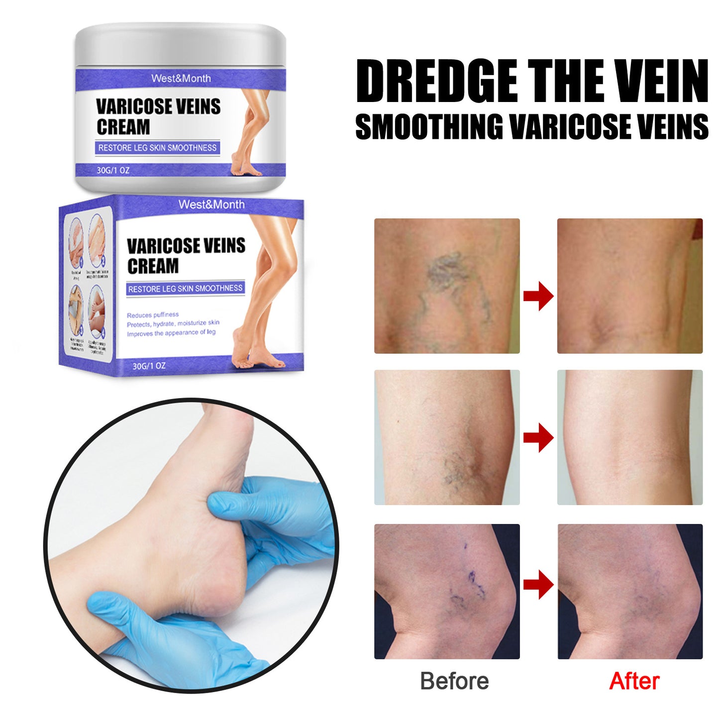 Vein Repair Cream