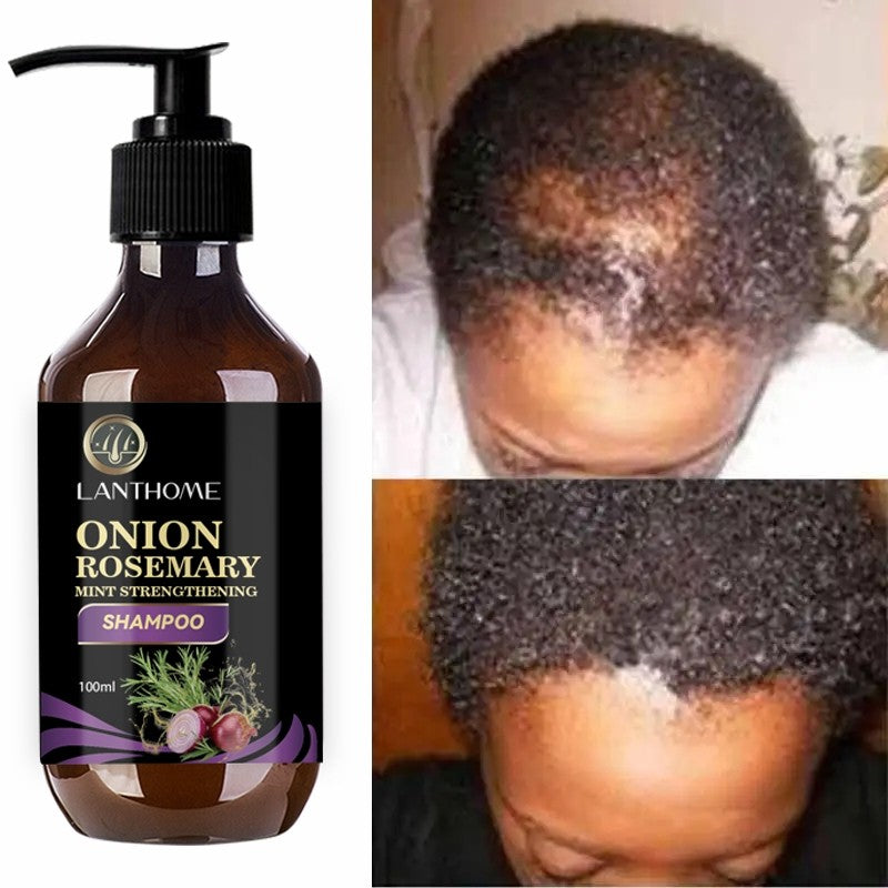 Rosemary Onion Shampoo for Hair Growth