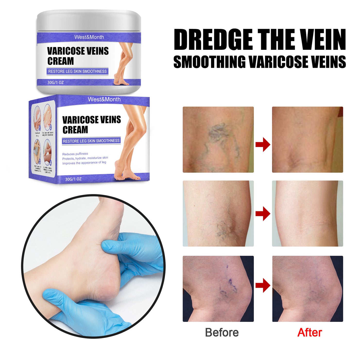 Vein Repair Cream