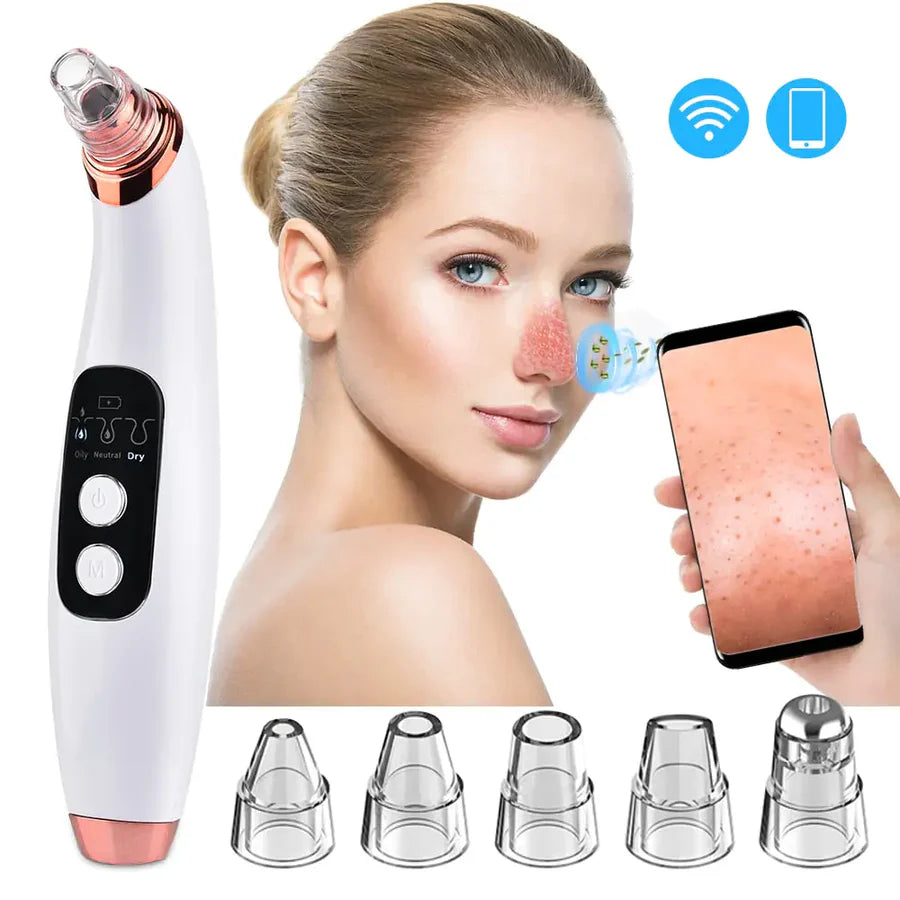 Charging device for removing blackheads, blackhead remover, facial cleansing instrument