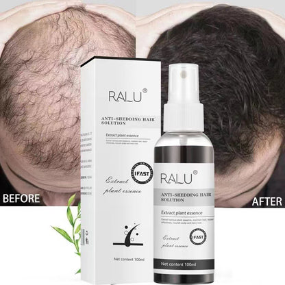 RALU Hair Growth Essence